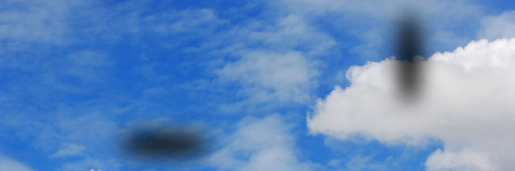 Eye Floaters – What are they and what should you do