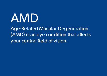 Brief description of AMD