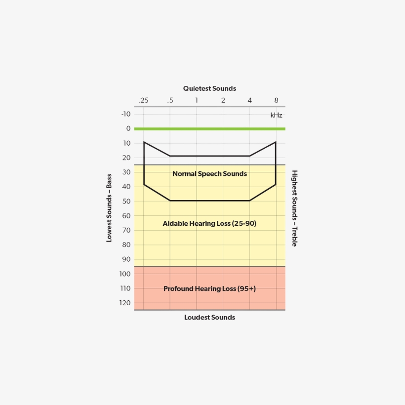 Graph showing sound range and where normal hearing and hearing loss is seen